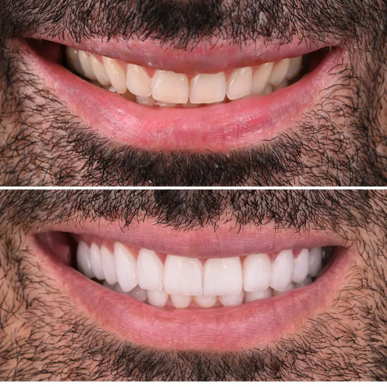  Common Dental Issues
